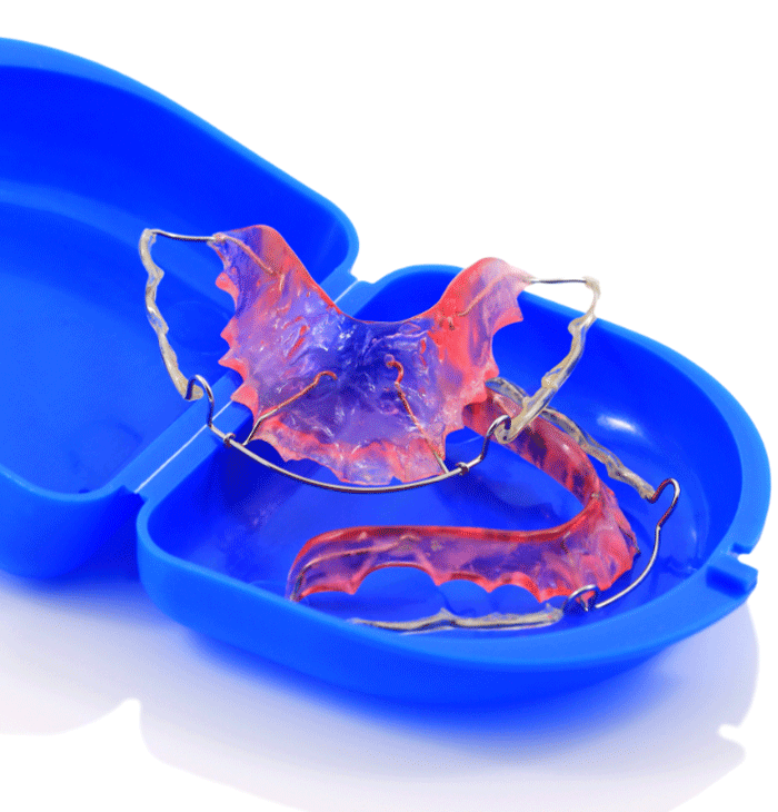 two dental retainers in a blue retainer case