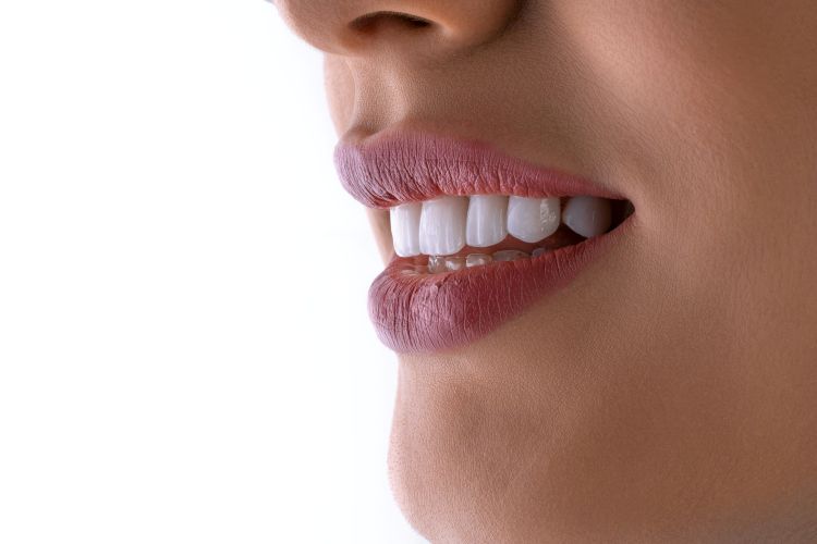 guide to preventing dental cavities
